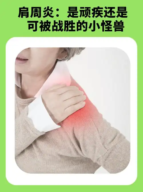 肩周炎.webp.png 肩周炎.webp.png