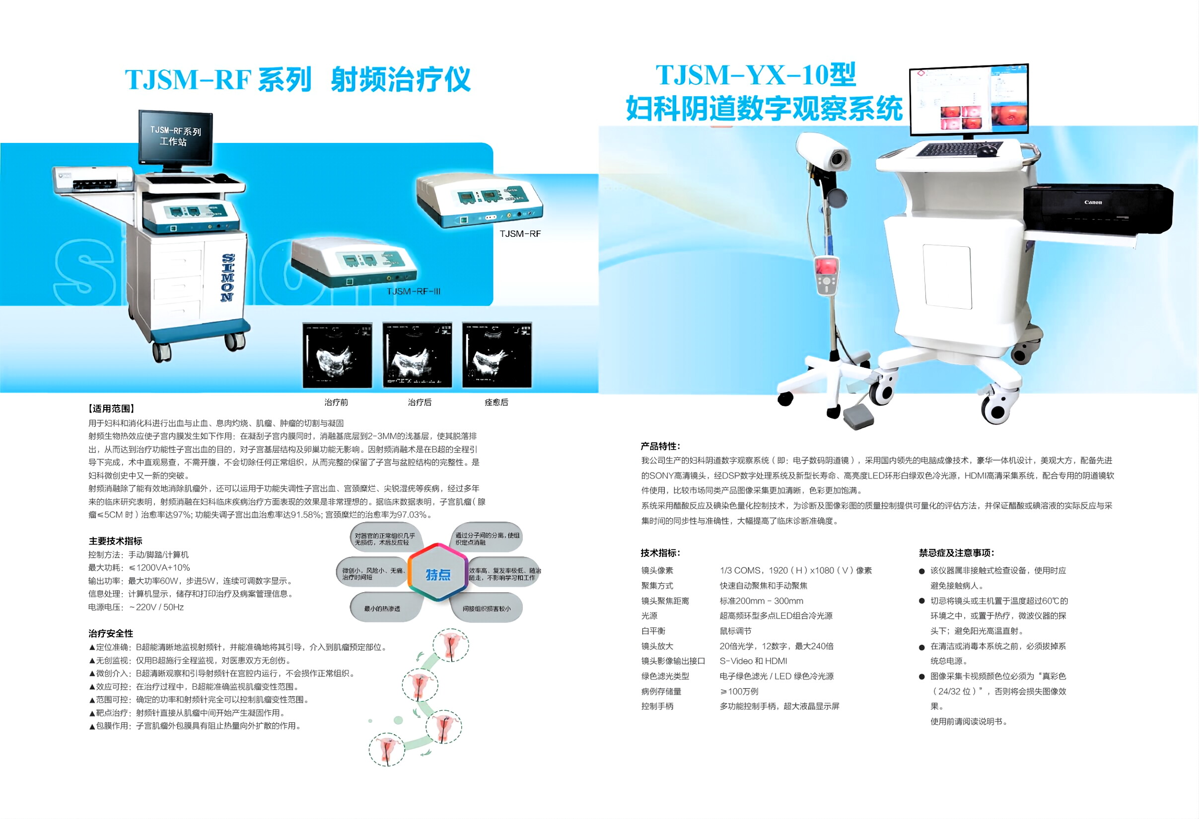 射频   阴道镜.jpeg